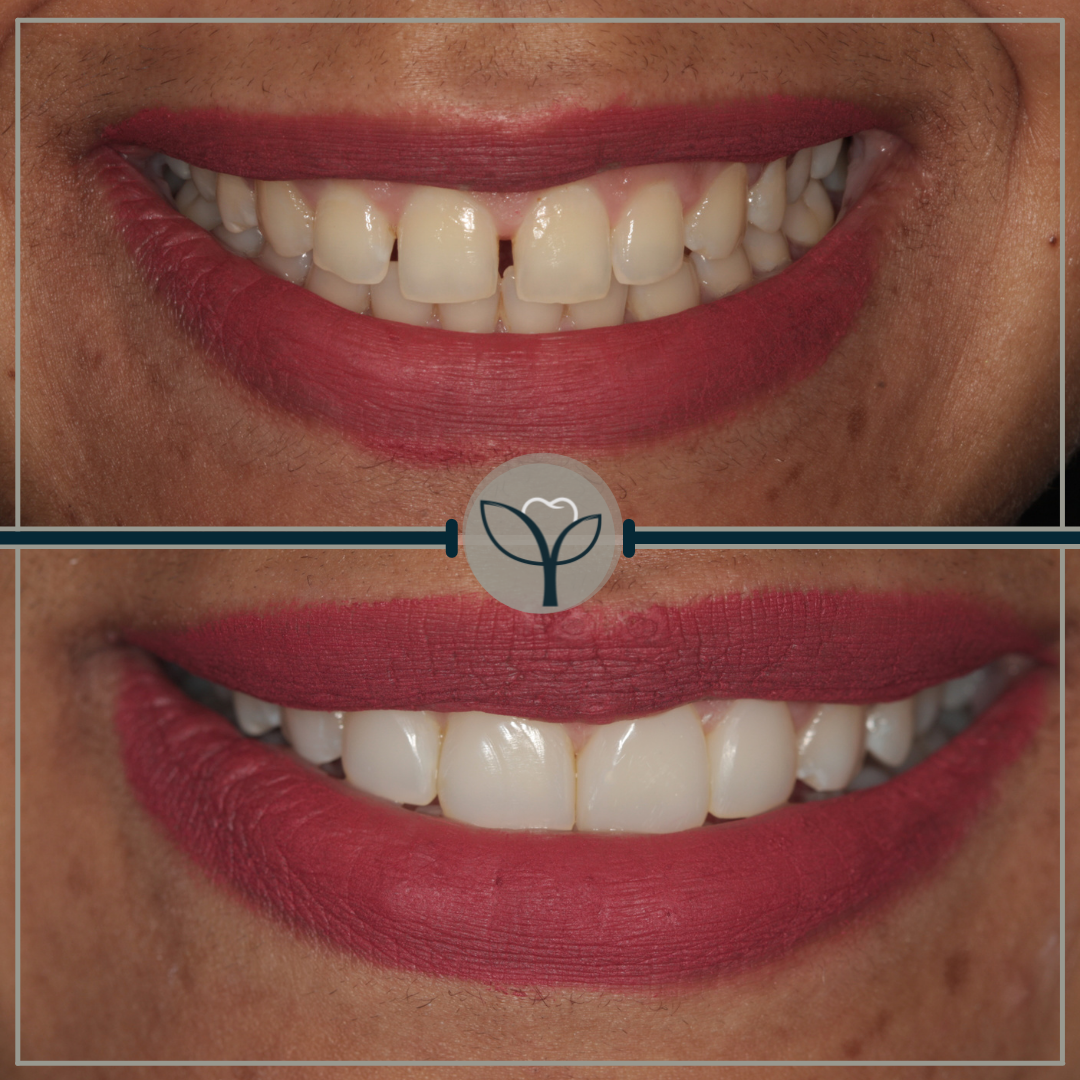 Copy of Copy of Copy of Copy of Copy of Copy of Copy of Copy of Copy of Copy of Marble And Pink Blog Instagram Post (11)