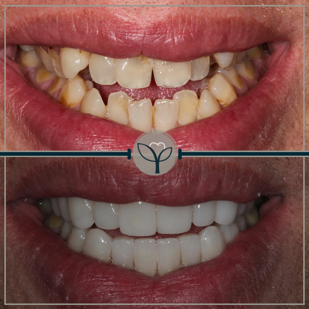 Copy of Copy of Copy of Copy of Copy of Copy of Copy of Copy of Copy of Copy of Marble And Pink Blog Instagram Post (5)