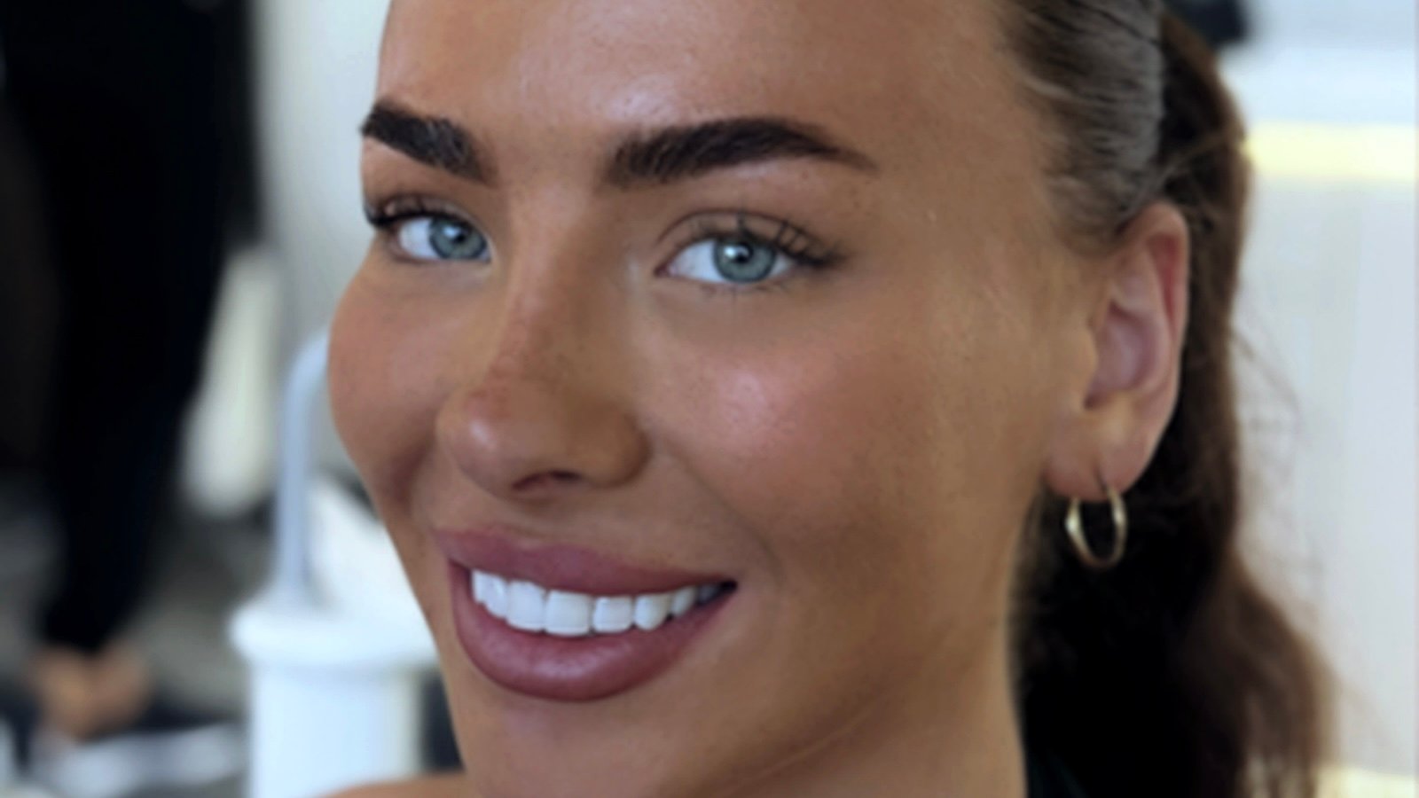 Cosmetic dentistry woman Yor Dental